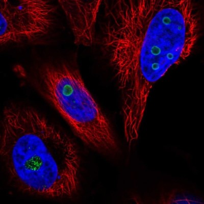 Immunocytochemistry/Immunofluorescence: WDR82 Antibody [NBP2-57428] - Staining of human cell line U-251 MG shows localization to nucleoli.