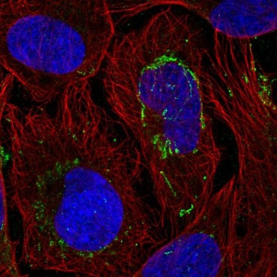Immunocytochemistry/Immunofluorescence: TTLL4 Antibody [NBP2-55634] - Staining of human cell line U-2 OS shows localization to mitochondria.