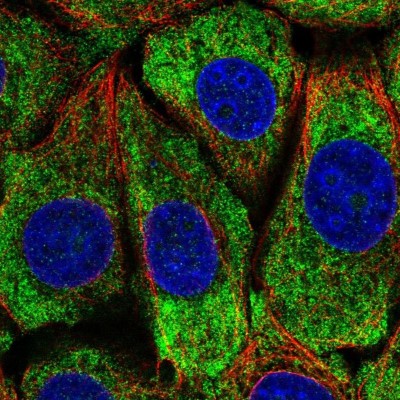 Immunocytochemistry/Immunofluorescence: MCG10 Antibody [NBP2-55526] - Staining of human cell line MCF7 shows localization to cytosol.
