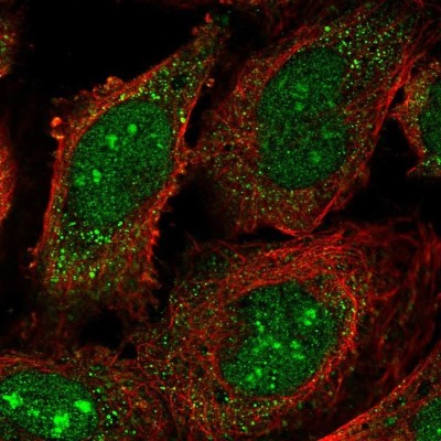 Immunocytochemistry/Immunofluorescence: HUCE1 Antibody [NBP2-55730] - Staining of human cell line U-2 OS shows localization to nucleus, nucleoli & cytosol.