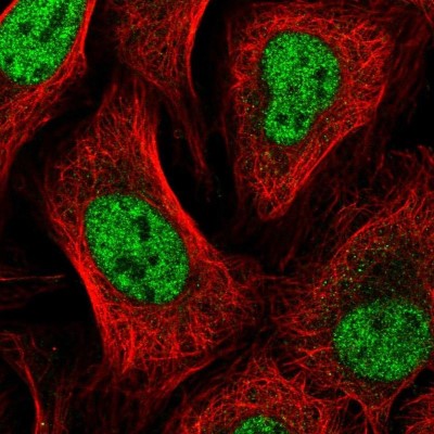 Immunocytochemistry/Immunofluorescence: GTF2A2 Antibody [NBP2-55408] - Staining of human cell line U-2 OS shows localization to nucleoplasm.