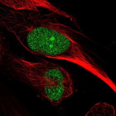 Immunocytochemistry/Immunofluorescence: ARNTL2 Antibody [NBP2-55861] - Staining of human cell line U-251 MG shows localization to nucleus & nucleoli.