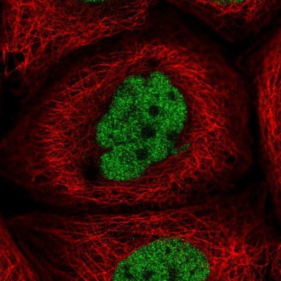 Immunocytochemistry/Immunofluorescence: CCDC94 Antibody [NBP2-55866] - Staining of human cell line A-431 shows localization to nucleoplasm.