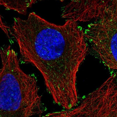 Immunocytochemistry/Immunofluorescence: Leupaxin Antibody [NBP2-55850] - Staining of human cell line U-2 OS shows localization to nuclear speckles, cytosol & focal adhesion sites.