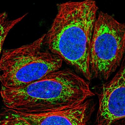 Immunocytochemistry/Immunofluorescence: GFM1 Antibody [NBP2-55712] - Staining of human cell line SiHa shows localization to nucleus & mitochondria.