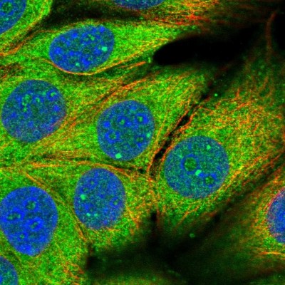 Immunocytochemistry/Immunofluorescence: PAFAH1B2 Antibody [NBP2-13725] - Immunofluorescent staining of human cell line MCF7 shows localization to nucleoli fibrillar center & cytosol.