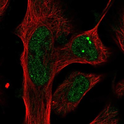 Immunocytochemistry/Immunofluorescence: Plxdc2 Antibody [NBP1-92278] - Staining of human cell line U-2 OS shows localization to nucleoplasm & nuclear bodies.