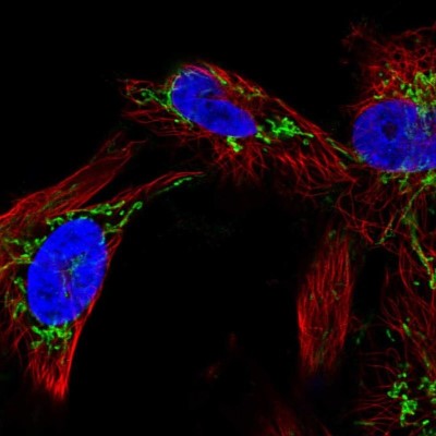 Immunocytochemistry/Immunofluorescence: CKIP-1 Antibody [NBP2-57588] - Staining of human cell line U-251 MG shows localization to mitochondria.