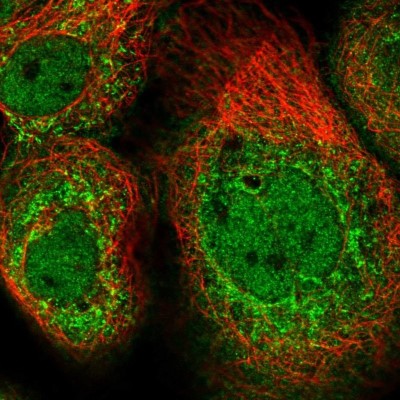Immunocytochemistry/Immunofluorescence: CLUAP1 Antibody [NBP2-58124] - Staining of human cell line A-431 shows localization to nucleoplasm & vesicles.