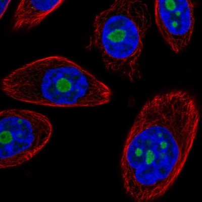 Immunocytochemistry/Immunofluorescence: DDX50 Antibody [NBP2-58135] - Staining of human cell line PC-3 shows localization to nucleoli.