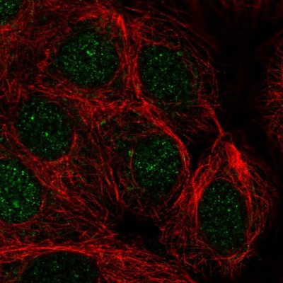 Immunocytochemistry/Immunofluorescence: PRPF38A Antibody [NBP2-32385] - Immunofluorescent staining of human cell line MCF7 shows localization to nucleus.