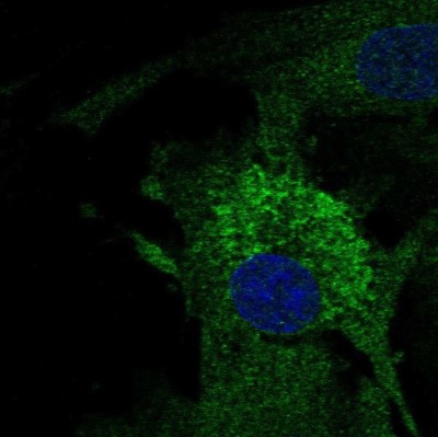 Immunocytochemistry/Immunofluorescence: MFAP4 Antibody [NBP2-30439] - Staining of human cell line BJ shows localization to endoplasmic reticulum.
