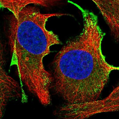 Immunocytochemistry/Immunofluorescence: CTDSPL Antibody [NBP2-31913] - Immunofluorescent staining of human cell line U-2 OS shows localization to vesicles.