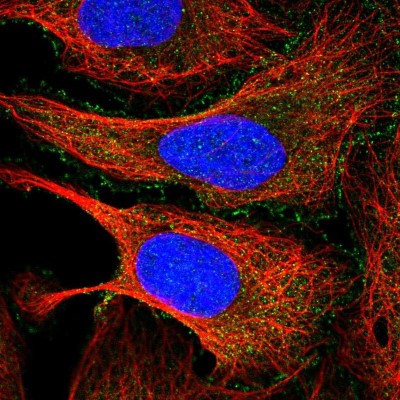 Immunocytochemistry/Immunofluorescence: PDCD7 Antibody [NBP2-13743] - Immunofluorescent staining of human cell line U-2 OS shows localization to plasma membrane.