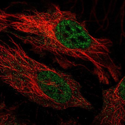 Immunocytochemistry/Immunofluorescence: FBXO34 Antibody [NBP2-31919] - Immunofluorescent staining of human cell line HeLa shows localization to nuclear speckles.