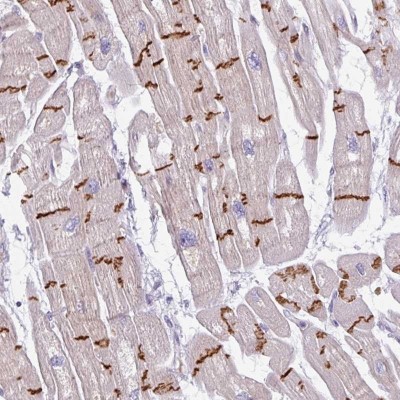Immunohistochemistry: C2orf68 Antibody [NBP2-31905] - Staining of human heart muscle shows strong positivity in intercalated discs.