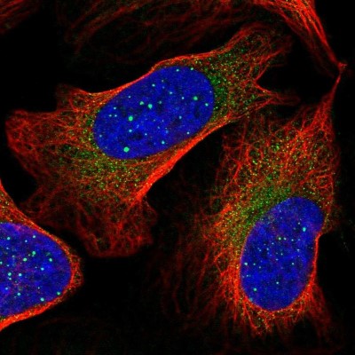 Immunocytochemistry/Immunofluorescence: ArgRS Antibody [NBP2-31923] - Immunofluorescent staining of human cell line U-2 OS shows localization to nuclear bodies & cytosol.