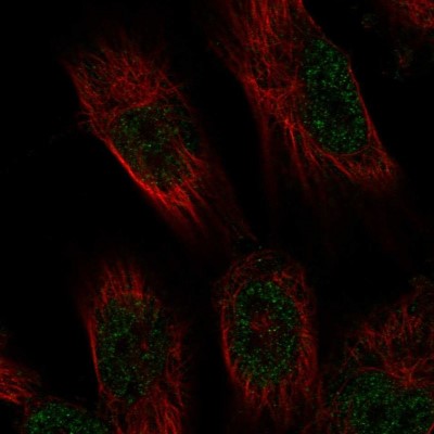 Immunocytochemistry/Immunofluorescence: UNC5D Antibody [NBP1-92562] - Staining of human cell line U-251 MG shows positivity in nucleus but not nucleoli.