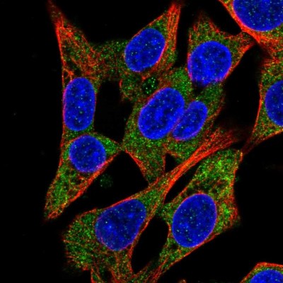 Immunocytochemistry/Immunofluorescence: QARS Antibody [NBP2-37883] - Immunofluorescent staining of human cell line Hep G2 shows localization to cytosol.