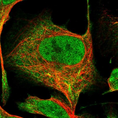 Immunocytochemistry/Immunofluorescence: R3HDM4 Antibody [NBP2-37902] - Immunofluorescent staining of human cell line U-2 OS shows localization to nucleus & cytosol.