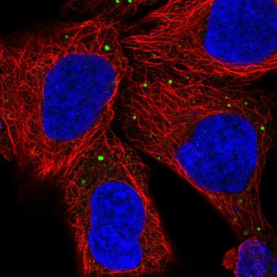 Immunocytochemistry/Immunofluorescence: PCSK1N Antibody [NBP2-49423] - Immunofluorescent staining of human cell line HEK 293 shows localization to vesicles.