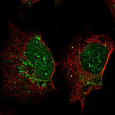 Immunocytochemistry/Immunofluorescence: SP140 Antibody [NBP2-49517] - Immunofluorescent staining of human cell line U-2 OS shows localization to nucleoli fibrillar center & mitochondria.