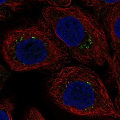 Immunocytochemistry/Immunofluorescence: AP1S3 Antibody [NBP2-49493] - Staining of human cell line HaCaT shows localization to vesicles.