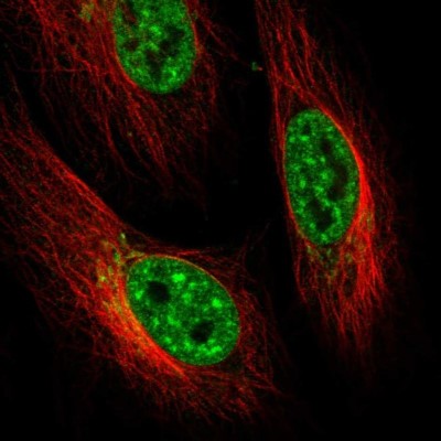 Immunocytochemistry/Immunofluorescence: ENTHD2 Antibody [NBP2-55976] - Staining of human cell line HeLa shows localization to nuclear speckles, nuclear membrane & the Golgi apparatus.