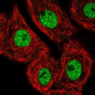 Immunocytochemistry/Immunofluorescence: MED25 Antibody [NBP2-55868] - Staining of human cell line A549 shows localization to nucleoplasm.