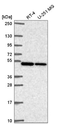 Western Blot: C2orf29 Antibody [NBP2-55823] - Western blot analysis in human cell line RT-4 and human cell line U-251 MG.