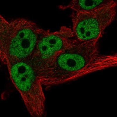 Immunocytochemistry/Immunofluorescence: C2orf29 Antibody [NBP2-55823] - Staining of human cell line SK-MEL-30 shows localization to nucleoplasm.