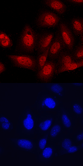 TBX18 was detected in immersion fixed Saos‑2 human osteosarcoma cell line using Mouse Anti-Human TBX18 Monoclonal Antibody (Catalog # MAB63371) at 10 µg/mL for 3 hours at room temperature. Cells were stained using the NorthernLights™ 557-conjugated Anti-Mouse IgG Secondary Antibody (red, upper panel; Catalog # NL007) and counterstained with DAPI (blue, lower panel). Specific staining was localized to nuclei. View our protocol for Fluorescent ICC Staining of Cells on Coverslips.