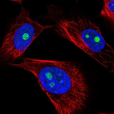 Immunocytochemistry/Immunofluorescence: GNL2 Antibody [NBP2-57167] - Staining of human cell line U-251 MG shows localization to nucleoli.