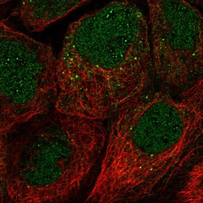 Immunocytochemistry/Immunofluorescence: FAM110A Antibody [NBP2-56326] - Staining of human cell line A-431 shows localization to nucleus, cytosol & vesicles.