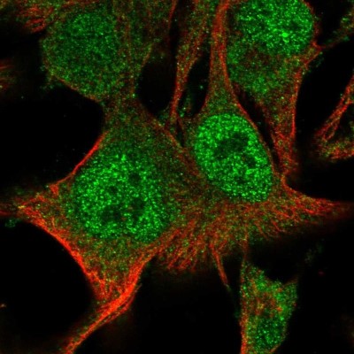 Immunocytochemistry/Immunofluorescence: BAL/PARP9 Antibody [NBP2-56376] - Staining of human cell line SK-MEL-30 shows localization to nucleoplasm & cytosol.