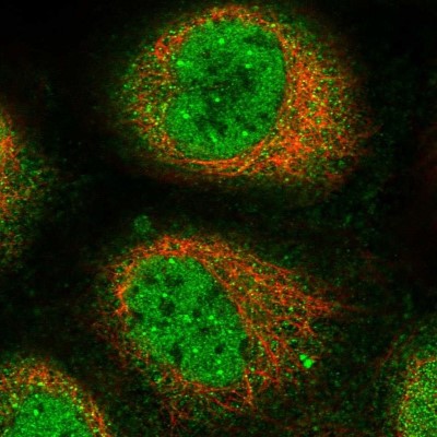Immunocytochemistry/Immunofluorescence: C14orf79 Antibody [NBP2-14516] - Staining of human cell line A-431 shows positivity in nucleus but not nucleoli, plasma membrane and cytoplasm.