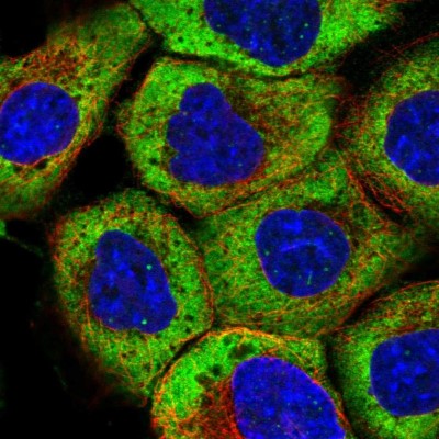 Immunocytochemistry/Immunofluorescence: RNF19B Antibody [NBP2-14688] - Immunofluorescent staining of human cell line A-431 shows localization to cytosol.