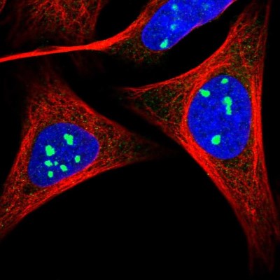 Immunocytochemistry/Immunofluorescence: CUTL2 Antibody [NBP1-91815] - Staining of human cell line U-2 OS shows positivity in nucleoli.
