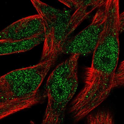 Immunocytochemistry/Immunofluorescence: Buster3 Antibody [NBP1-91707] - Immunofluorescent staining of human cell line RH-30 shows localization to nucleoplasm.