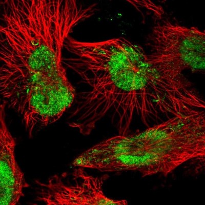 Immunocytochemistry/Immunofluorescence: FLJ10154 Antibody [NBP2-58390] - Staining of human cell line U-251 MG shows localization to nucleoplasm & mitochondria.