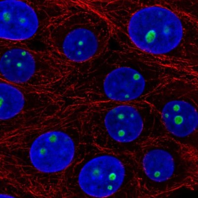Immunocytochemistry/Immunofluorescence: LLPH Antibody [NBP2-55472] - Staining of human cell line MCF7 shows localization to nucleoli.