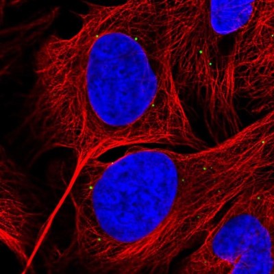Immunocytochemistry/Immunofluorescence: GRK4 Antibody [NBP2-55415] - Staining of human cell line U-2 OS shows localization to vesicles.