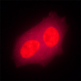 Bora was detected in immersion fixed MCF‑7 human breast cancer cell line using Mouse Anti-Human Bora Monoclonal Antibody (Catalog # MAB6856) at 25 µg/mL for 3 hours at room temperature. Cells were stained using the NorthernLights™ 557-conjugated Anti-Mouse IgG Secondary Antibody (red; Catalog # NL007). Specific staining was localized to nuclei. View our protocol for Fluorescent ICC Staining of Cells on Coverslips.