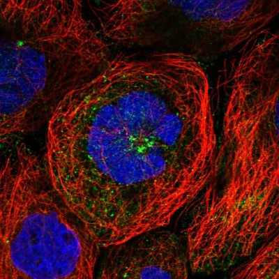 Immunocytochemistry/Immunofluorescence: WDR11 Antibody [NBP1-89930] - Immunofluorescent staining of human cell line A-431 shows localization to cytosol.