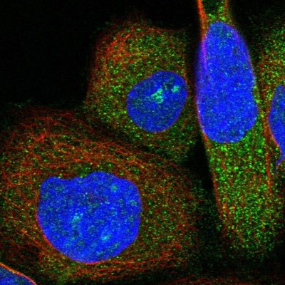 Immunocytochemistry/Immunofluorescence: BPOZ Antibody [NBP1-89944] - Immunofluorescent staining of human cell line A-431 shows localization to nucleoli & cytosol.