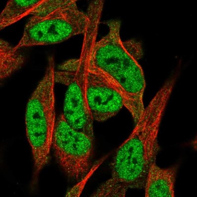 Immunocytochemistry/Immunofluorescence: TNRC4 Antibody [NBP1-89933] - Immunofluorescent staining of human cell line SH-SY5Y shows localization to nucleoplasm.