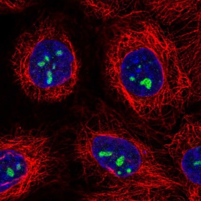 Immunocytochemistry/Immunofluorescence: ATP13A3 Antibody [NBP1-90867] - Immunofluorescent staining of human cell line A-431 shows localization to nucleoli.