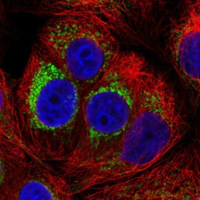 Immunocytochemistry/Immunofluorescence: PMPCA Antibody [NBP2-57169] - Staining of human cell line MCF7 shows localization to mitochondria.