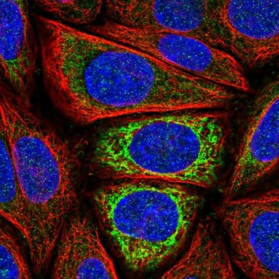 Immunocytochemistry/Immunofluorescence: IDH3A Antibody [NBP2-57139] - Staining of human cell line SiHa shows localization to mitochondria.