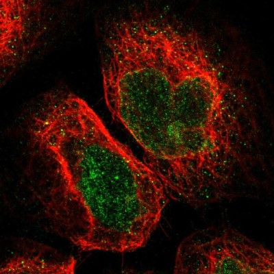 Immunocytochemistry/Immunofluorescence: KIAA1549 Antibody [NBP1-91082] - Immunofluorescent staining of human cell line A-431 shows localization to nuclear membrane.